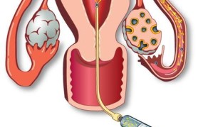 人工授精生子法律地位如何明确？有哪些法律依据？