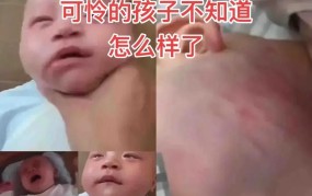 小孩子打小孩子怎么处理？如何教育孩子？