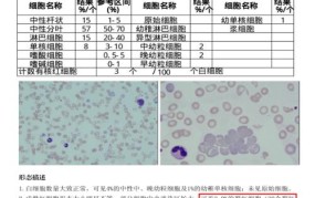 骨髓增生程度分级标准中粒红比是什么？